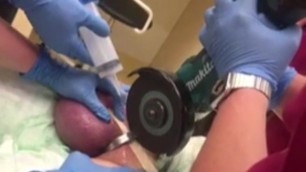 Funny Doctors Broke metal ring in His Ball testicle obstacle